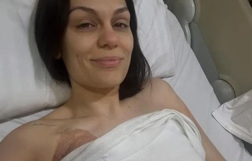 知名歌手“结石姐”分享乳腺癌术后照片：病容憔悴身上缠着绷带，已回家休养等待结果|jessie j|音乐节|自拍|潇湘晨报|布利