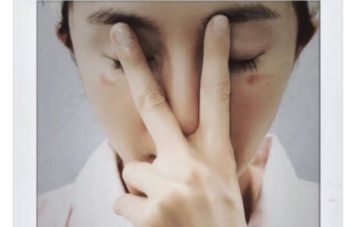 杨幂发了一张自拍图，透露被蒸汽眼罩伤到，眼部烫伤竟被恶意造谣