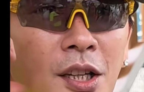 46岁演员黄宗泽“牙龈萎缩”引关注